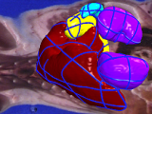 thumbnail14